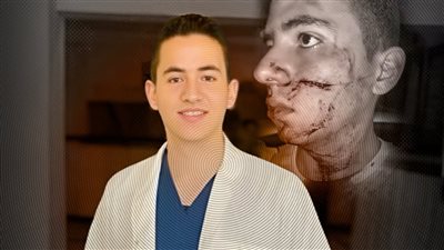 بلطجي دمياط يشوه وجه طبيب شاب ويحاول حرق منزله بالمولوتوف