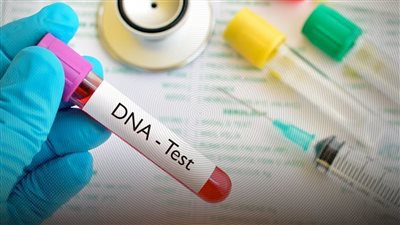 القبض على طبيبة تحاليل مزيفة روجت لعدم تطابق نتائج تحاليل الـDNA بمعملها