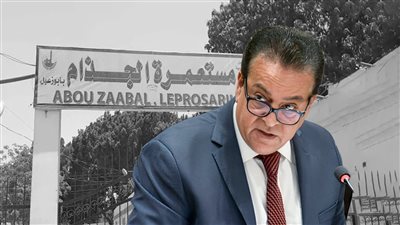 أول توضيح من الصحة بشأن غلق مستعمرة الجذام واستثمار أرضها