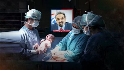 الضرر يمتد للأبناء..خطة الحكومة للحد من الولادة القيصرية بنسبة 15% حد أقصى 
