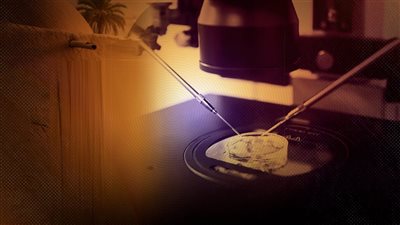 زوج يؤجر رحم زوجته دون علمها لزوج شقيقته العاقر لإنجاب توام بعملية حقن مجهرى 